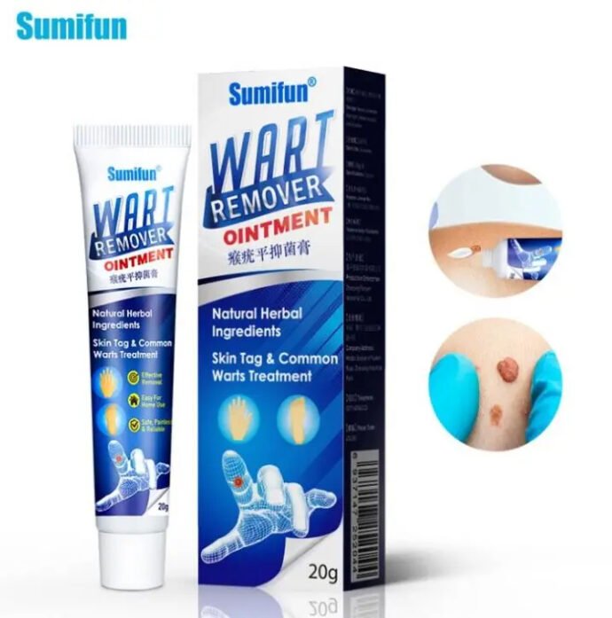 Wart Remover
